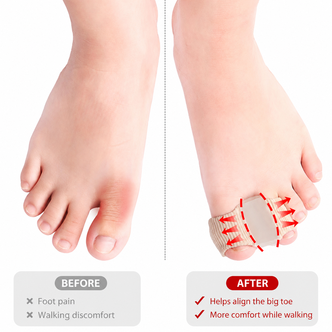 Premium Silicone Bunion Corrector & Toe Aligner