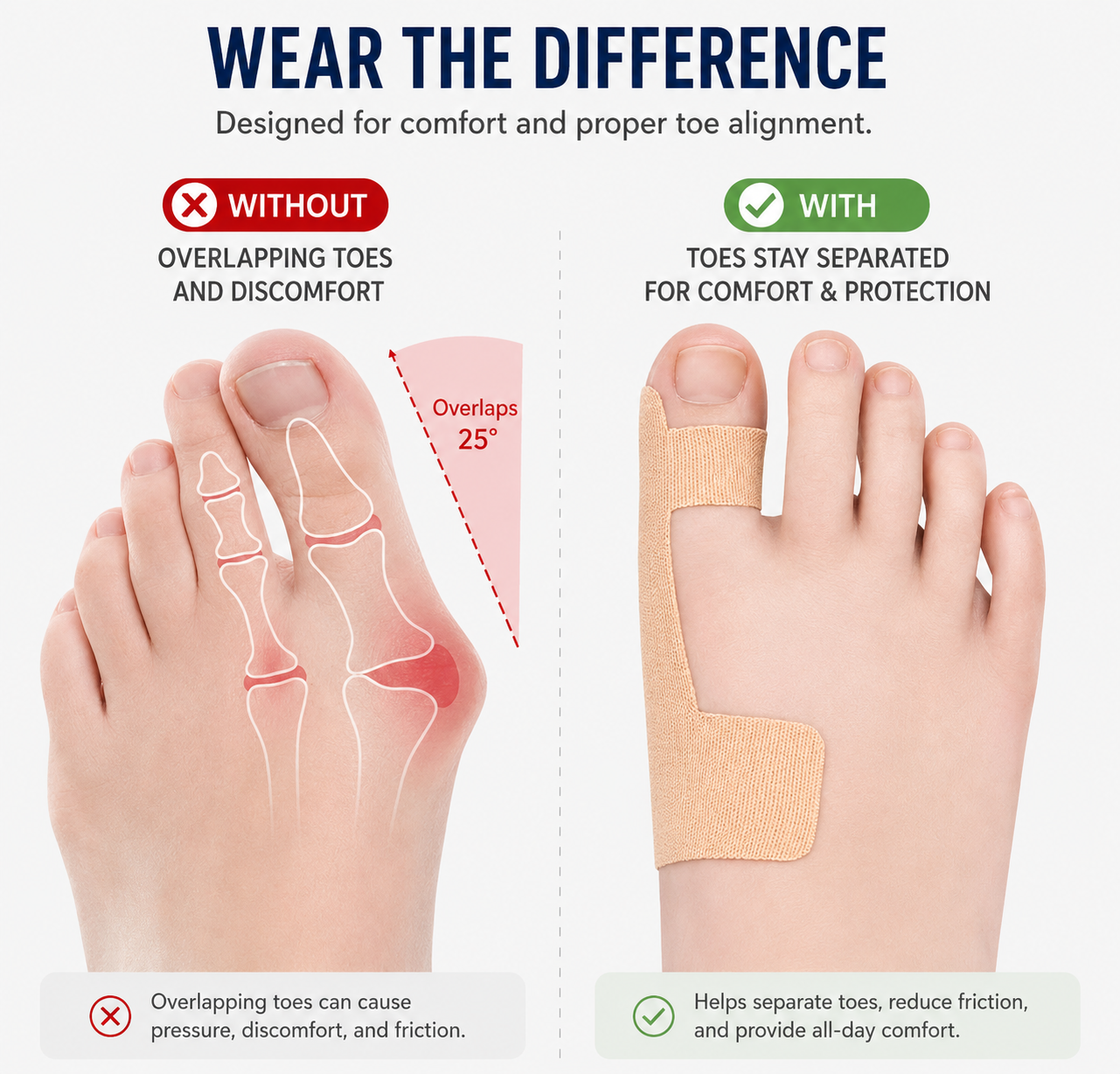 Toe Alignment corrector Tape Bunion Relief & Big Toe Support Brace